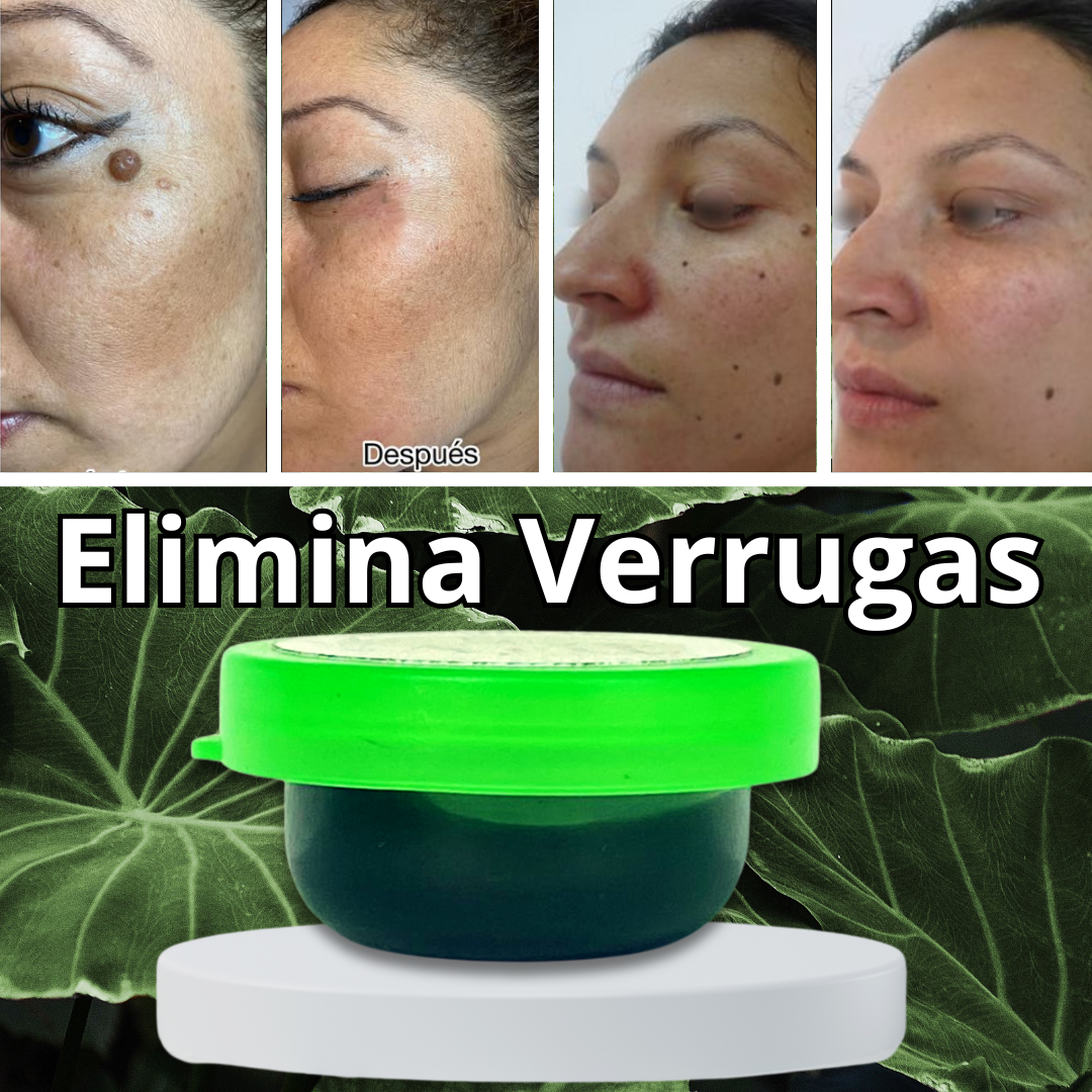 Crema Elimina Verrugas, lunares 100% eficaz